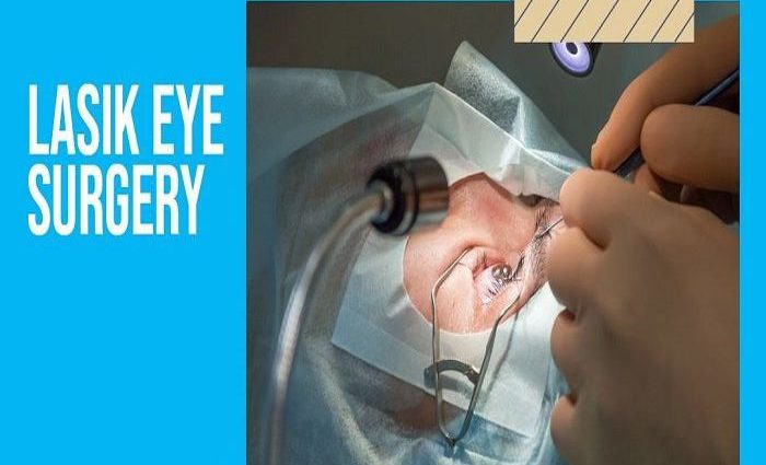 Everything You Need To Know About Lasik Eye Surgery Health Perfect Info