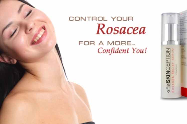 Rosacea Relief Serum Review: Ingredients, Benefits, Side Effects, Usage and Pros & Cons